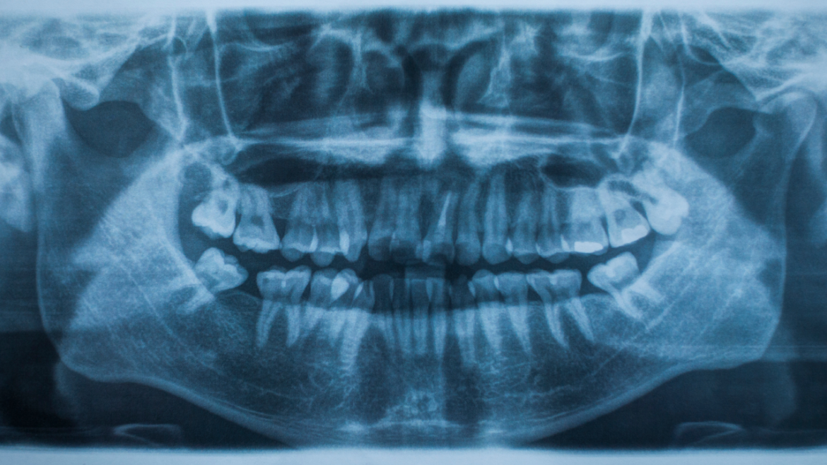 Ionizing Radiations Why X rays Matters